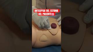 Antisepsia del ESTOMA del PACIENTE ostomia enfermeria auxiliardeenfermeria [upl. by Aehcsrop532]