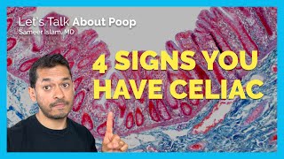 4 Signs Of Celiac Disease [upl. by Rimaa320]