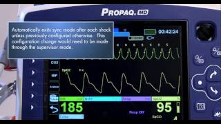 Propaq MD Synchronized Cardioversion [upl. by Ynnahc]