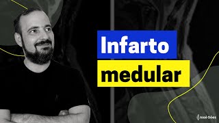 Infarto medular  José Góes [upl. by Xed]