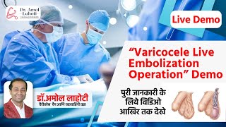 Understanding Varicocele Treatment  Angiography amp Wire Placement in Embolization  Dr Amol Lahoti [upl. by Llertnom589]