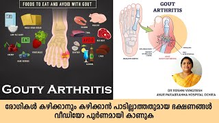 Gouty arthritis നിയന്ത്രിക്കേണ്ട ആഹാരങ്ങൾ  Dr Roshni Ayur Talks  Ayurveda  Malayalam [upl. by Frieda]