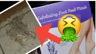 FOOT PEEL TRANSFORMATION [upl. by Amii]