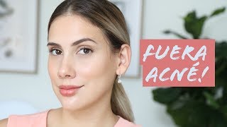 Tips mascarillas y productos no invasivos para el acne  Carolina Ortiz [upl. by Eldoree]