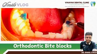 Orthodontic Bite block Shorts YouTubeShorts Viral Trending [upl. by Risley]