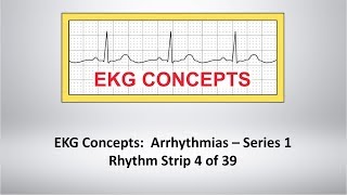 EKG Concepts Arrhythmias Course  Strip 4 of 39 [upl. by Siravart]