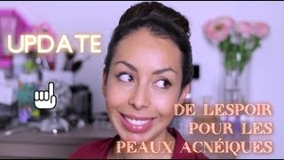 Update Routine Visage suite de ma lutte contre lacné [upl. by Namolos]