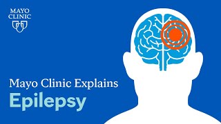 What is epilepsy A Mayo Clinic expert explains [upl. by Ekez618]