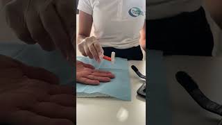 STIMOLAZIONE NEUROLOGICA PER RIABILITAZIONE DELLA MANO CON ERGOTERAPISTA [upl. by Dallon]