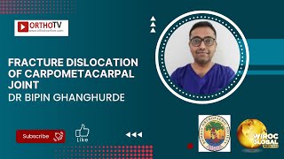 Fracture dislocation of Carpometacarpal joint  Dr Bipin Ghanghurde [upl. by Cromwell]