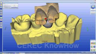 CEREC® Crown Multilayer  Crown  Software [upl. by Aleece]