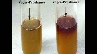 VogesProskauer Test  Amrita University [upl. by Yewed]