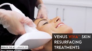 Venus Viva™ Skin Resurfacing Treatments [upl. by Asirahc834]