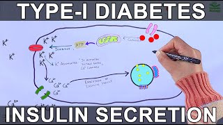 Type I Diabetes Mellitus  Mechanism [upl. by Pammy]