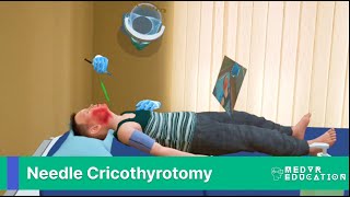 Needle Cricothyrotomy in Virtual Reality and Mixed Reality [upl. by Glaser]