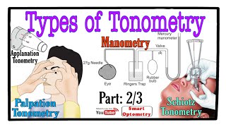 Tonometry All Types of Tonometry 23 [upl. by Clementius387]