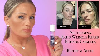 Neutrogena Rapid Wrinkle Repair Retinol Capsules  Before and After Pictures [upl. by Beret]