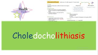 Choledocholithiasis  Etiology Pathophysiology Types Clinics Diagnosis Treatment [upl. by Laon834]