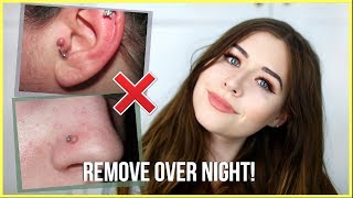 How To Get Rid Of Piercing Bumps OVERNIGHT [upl. by Mikael]