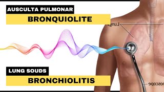 BRONQUIOLITE AUSCULTA PULMONAR  Bronchiolitis Lung Sounds [upl. by Alyehs134]