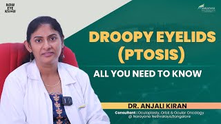 Droopy Eyelids Ptosis Explained  Dr Anjali Kiran  English [upl. by Fleda]