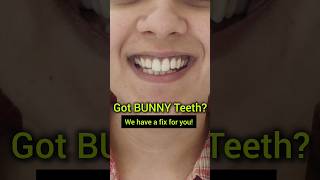 Got BUNNY Teeth Watch this video now Dr Srishti Bhatia smile smilemakeover braces [upl. by Nedrob]