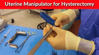 Uterine Manipulator for Hysterectomy  Dr Kunal Rathod [upl. by Paulie]