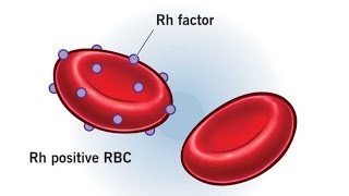 Rh Negative Pregnancy [upl. by Virgy291]