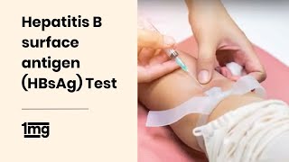 Hepatitis B surface antigen HBsAg Test  1mg [upl. by Enirtak]