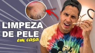 Como fazer LIMPEZA de pele EM CASA  MUITO FÁCIL [upl. by Damales45]