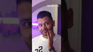 Beard Transplant in Dubai  Beard Transplant Before amp After  Hair Transplant Clinic  Bizrahmed [upl. by Daniala]