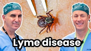 Lyme Disease and Ticks  Causes Treatments and More [upl. by Melosa]