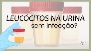 PRESENÇA DE LEUCÓCITOS NA URINA SEM INFECÇÃO PODE ACONTECER [upl. by Omrellig]