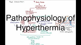 Hyperthermia Pathophysiology [upl. by Akanke]