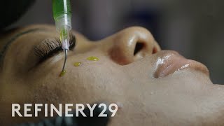 I Tried a Chemical Peel for Glass Skin BioRePeel  Macro Beauty  Refinery29 [upl. by Mick]