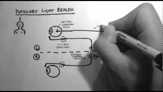 Reflexes 2  Pupillary Light Reflex [upl. by Dietsche]