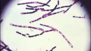 Bacillus 🦠 SPP Silica Solubilizer Plant Growth Promoting Bacteria For Huge Plants and yield [upl. by Euqirdor]