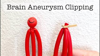 Playdough Surgery 🔪🧠🍒  Brain Aneurysm Clipping [upl. by Asirehc]