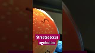 Streptococcus agalactiae  рост стрептококка с гемолизом на кровяном агаре [upl. by Hester]