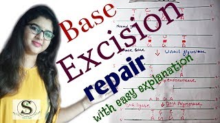 DNA repair mechanism  Base excision repair \\ make it simple [upl. by Leseil]