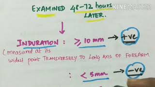 M  TUBERCULOSIS microbiology [upl. by Ecneps620]