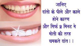 Teeth Whitening Remedy Easy Remedy For White Teeth Danto K Chamkane Ke Upaye [upl. by Yhtir250]