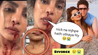 Priyanka Chopra Shocking Statement after Divorce with nick Jonas 😯😱 [upl. by Hazrit14]