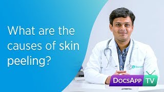 What are the causes of Skin Peeling AsktheDoctor [upl. by Darcy426]