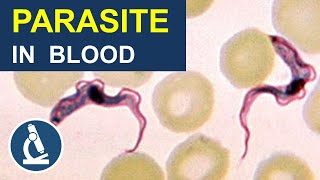 Blood Parasite That Makes You Sleepy Trypanosoma Under the Microscope [upl. by Lindsay]