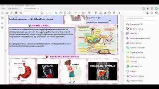 SINDROME ZOLLINGER ELLISON FLASHCARD GPC ENARM [upl. by Rolecnahc]