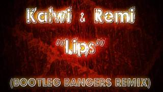 Kalwi amp Remi  Lips Bootleg Bangers remix [upl. by Arron285]