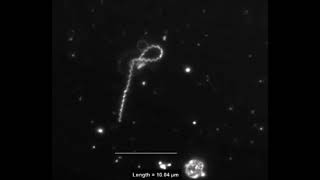 Interaction of Treponema pallidum the syphilis spirochete with human platelets [upl. by Judus467]