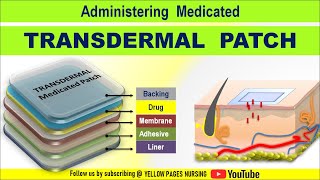 Transdermal Medicated patch  Transdermal patch  Transdermal Drug Delivery TDD  Made Easy [upl. by Kries]