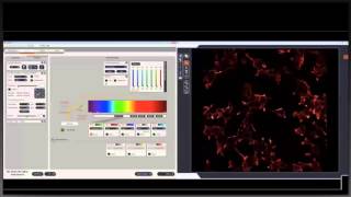 What is a Confocal Microscope  Webinar Leica Microsystems [upl. by Dera]